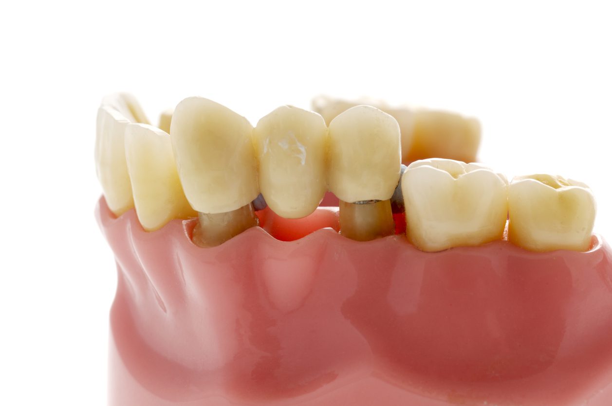 Brenchley Dental Payment Services