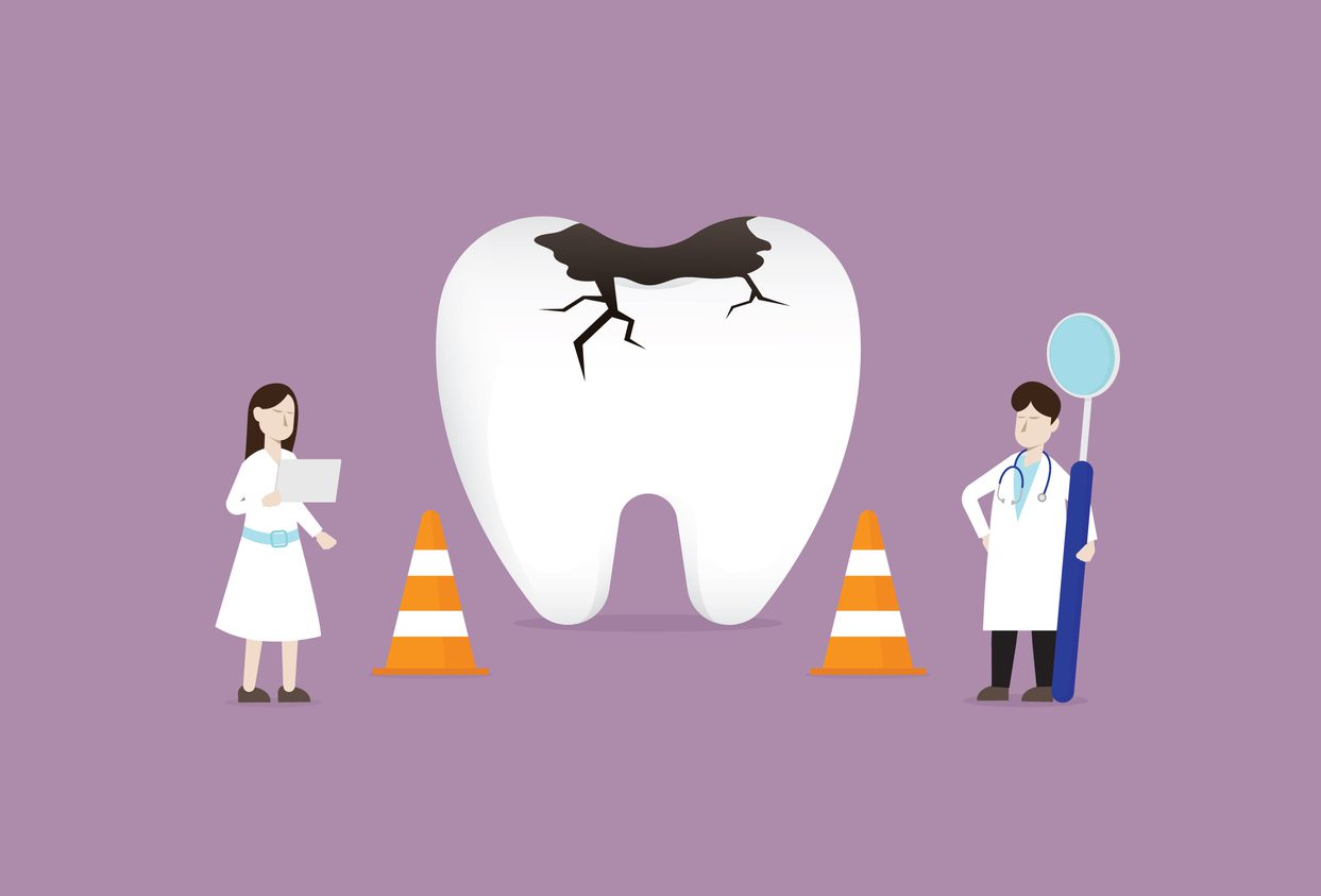 filling tooth decay