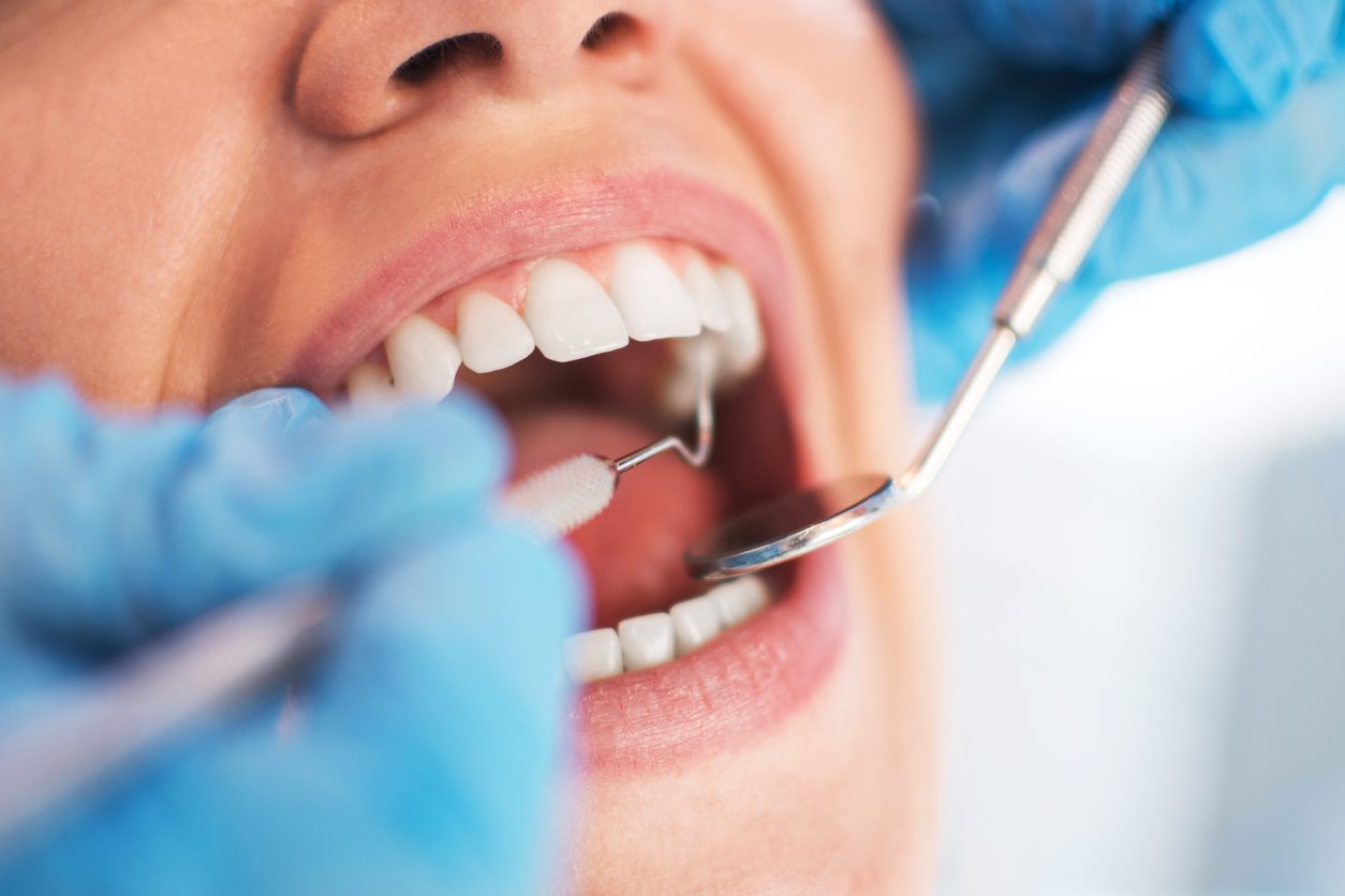 orthodontic treatments