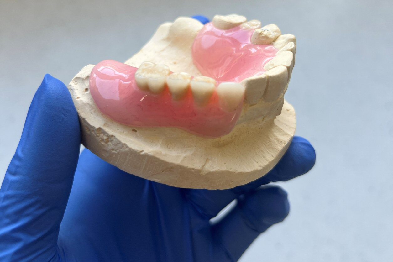 Dentures