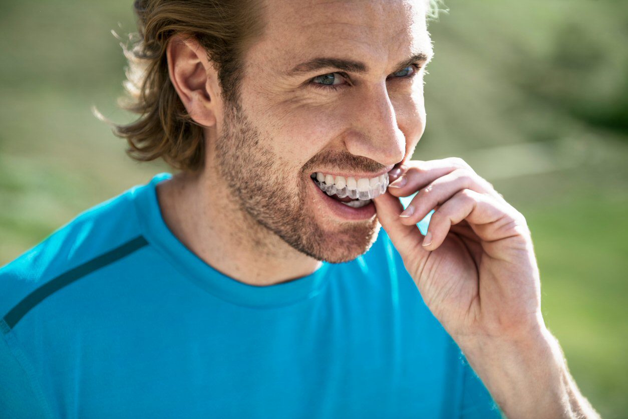 Invisalign 2