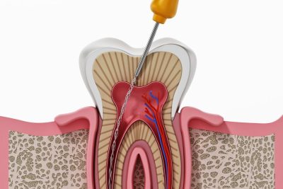 Teeth cleaning dentists
